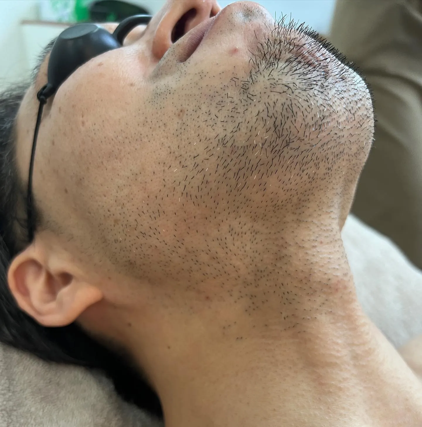 男性で1番ご希望があるのが